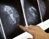 Imagens da mama: anatomia e patologias